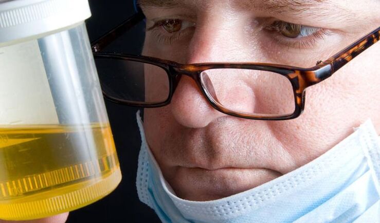 šlapimo analizė dėl lėtinio prostatito